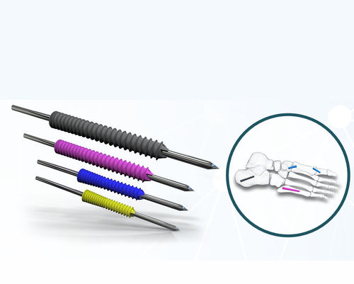 Vite per compressione ossea per alluce valgo - EXN02 series - Aleda Medical - canalare / senza testa / in metallo