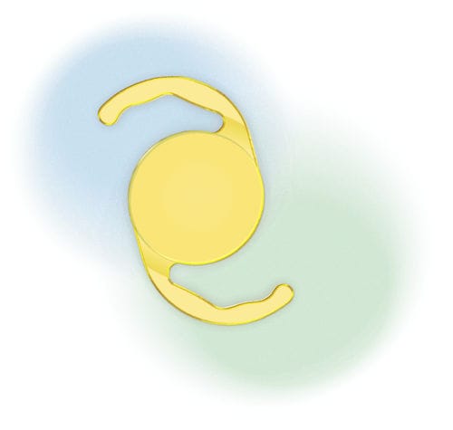 Lente intraoculare monofocale - Ev gold - Aurolab