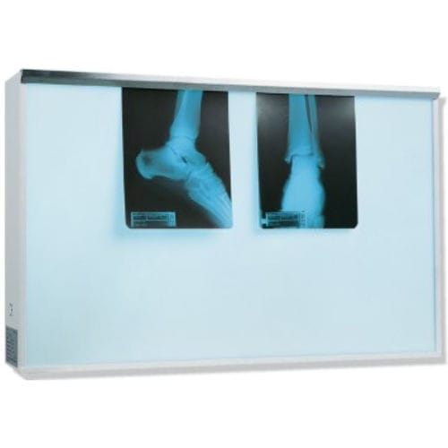 Negativoscopio 2 corpi - K606671 - Karrel Health Solutions - a luce bianca / con interruttore