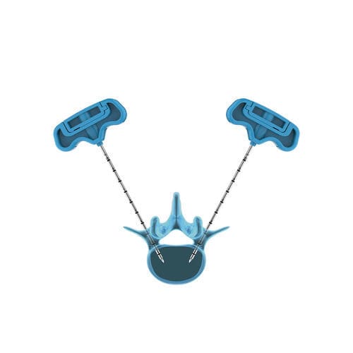 Sistema di aumento vertebrale ago - PVP - Hicren Zhejiang Medtech - per vertebroplastica percutanea