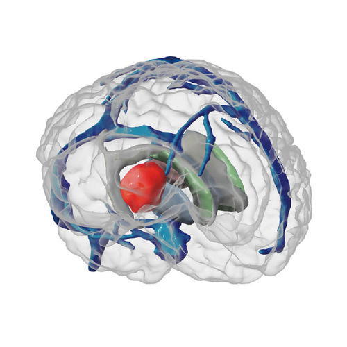 Phantom di calibrazione per radiochirurgia - ANATDEL - MEDICALIP Co., Ltd. - per radiografia / di cervello