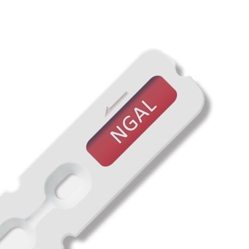 Kit di test di siero - 00020C - Beijing O&D Biotech Co., Ltd. - al plasma / di sangue totale / per urina