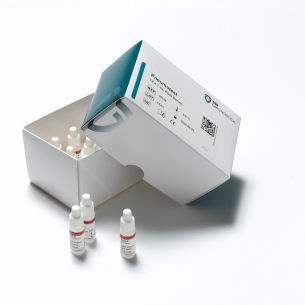 Kit di reagenti di siero - 36158 - SSI Diagnostica - antisiero / anticorpo / di serologia