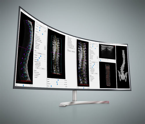 Software clinico - Scoliostudio® - Scolioscan - per radiologia / di analisi / di visualizzazione 3D