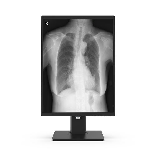 Monitor medico - 21X3M-I3 - KTC Medical Solutions - chirurgico / diagnostico / per radiologia
