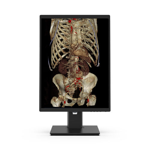 Monitor medico - 21X3C-I3 - KTC Medical Solutions - diagnostico / per radiologia / 21.3"