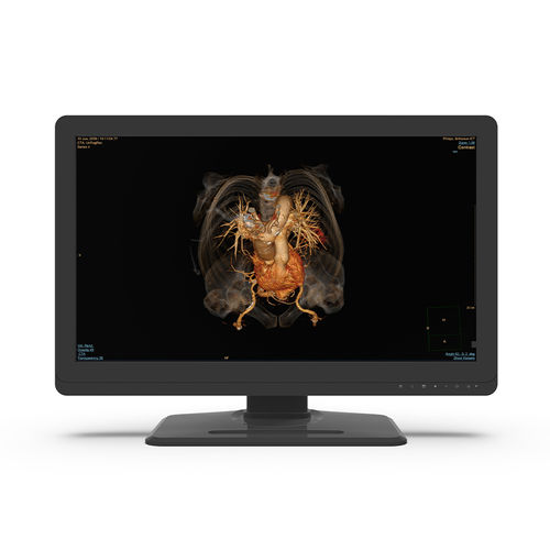 Monitor medico - 27X4C-I0 - KTC Medical Solutions - diagnostico / per radiologia / QHD