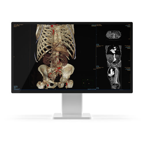 Monitor medico - 27X4C-K1 - KTC Medical Solutions - diagnostico / per radiologia / QHD