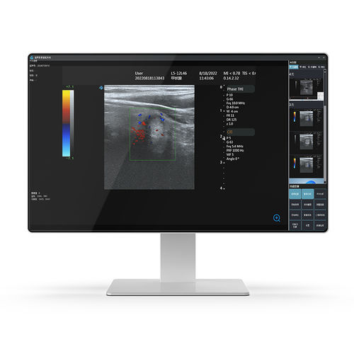 Computer medicale Intel® Core i7 - 24H32 - KTC Medical Solutions - per carrelli informatici / per struttura sanitaria / per diagnostica per immagini