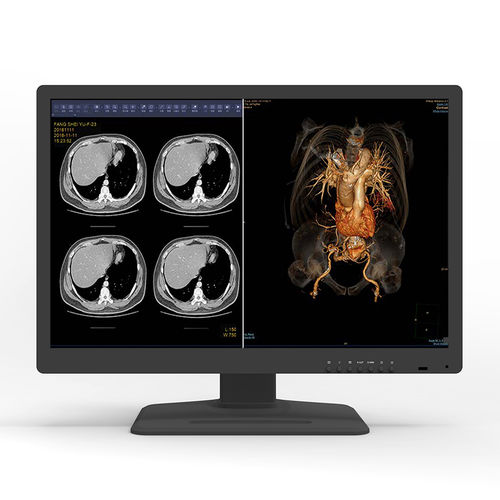 Monitor medico - 30X6C-I1 - KTC Medical Solutions - diagnostico / per radiologia / 30"