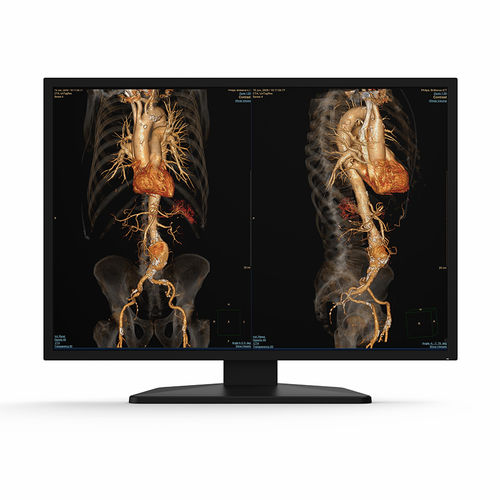 Monitor medico - 31X12C - KTC Medical Solutions - diagnostico / per radiologia / 4K