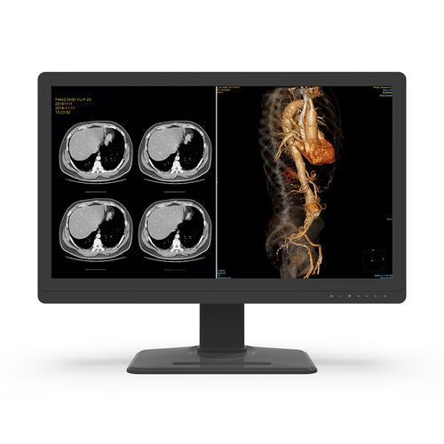 Monitor medico - 32X8C-L0S - KTC Medical Solutions - diagnostico / per radiologia / 3840 × 2160