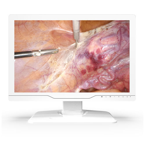 Monitor medico - 24A30 - KTC Medical Solutions - per sala operatoria / per endoscopia / 1920x1200