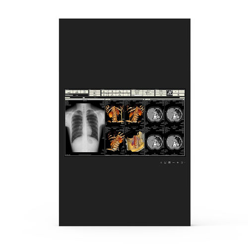 Monitor medico - 24H90 - KTC Medical Solutions - per sala operatoria / 1920 x 1080 / 23,8"