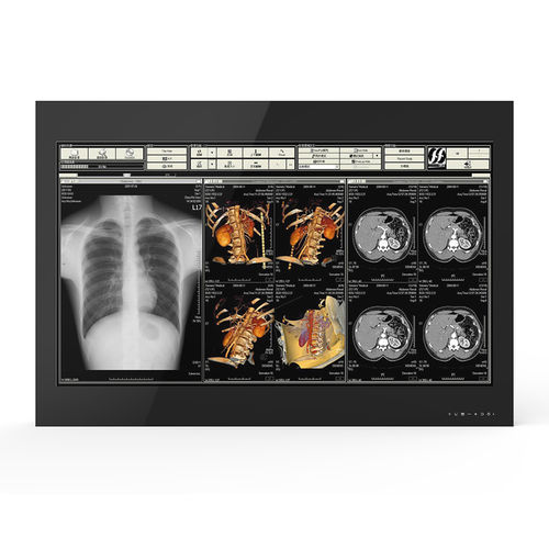 Monitor medico - 55H90 - KTC Medical Solutions - per sala operatoria / 3840 × 2160 / 55"