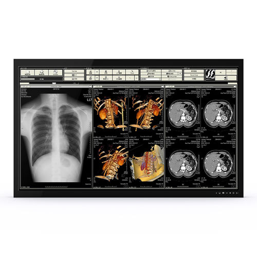 Monitor medico - 65H90 - KTC Medical Solutions - per sala operatoria / 3840 × 2160 / 65"
