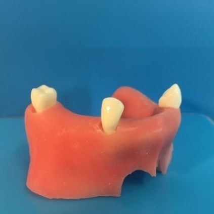 Modello anatomico di mascella - DOTFOX
