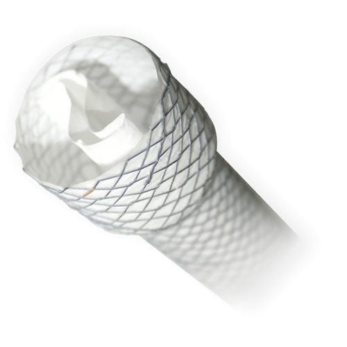 Stent esofageo - BRAVO - MITRA Industries - in metallo