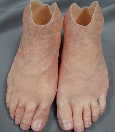 Protesi estetica per piede - Medical Art Prosthetics - per adulti