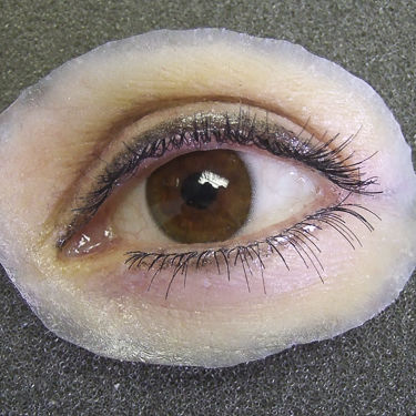 Protesi estetica orbitale - Medical Art Prosthetics - per adulti