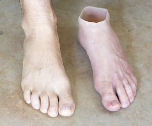 Protesi estetica per piede - Northern Prosthetics - per adulti
