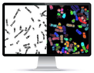 Sistema di imaging cellulare automatico - HiBand™ - Applied Spectral Imaging - da laboratorio / diagnostico / per citogenetica