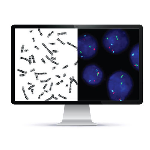 Sistema di imaging cellulare automatizzato - CytoPower™ - Applied Spectral Imaging - da laboratorio / per citogenetica / FISH