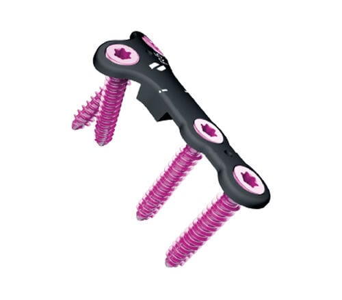 Placca per osteotomia per alluce valgo - Airlock® - novastep - bloccata / in metallo