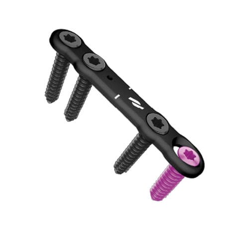 Placca per osteotomia per avampiede - Airlock® - novastep - bloccata / in metallo