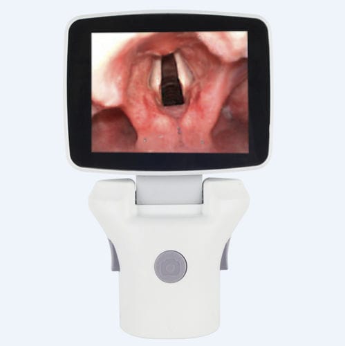 Videolaringoscopio con video monitor integrato - TL-100V-Ⅱ - Shenzhen Tianlang Medical Equipment - con lama