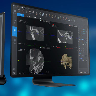 Software medico - SmartV-ENT - LargeV Instrument - per implantologia dentale / per diagnostica per immagini / ORL