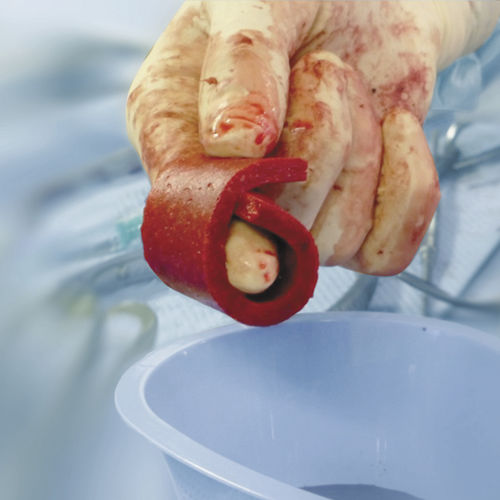 Sostituto osseo xenotrapianto - Cerasorb® Foam - Curasan - per chirurgia ortopedica / conformabile