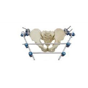 Fissatore esterno di pelvi - T8012 - Orthopromed - tubolare / per adulti