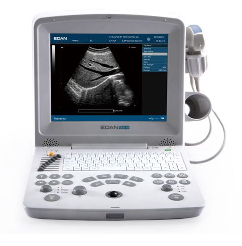 Ecografo portatile - DUS60 - JFB International - per ecografia ginecologica ed ostetrica / per ecografia urologica / per ecografia muscolo-scheletrica