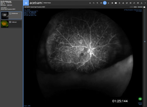 Software visualizzatore - vieviewer Clinic - NEHS DIGITAL - di condivisione / d’importazione / medico