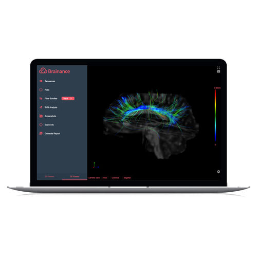 Software MRI - Brainance MD  - Advantis Medical Imaging - per imaging cerebrale / per MRI funzionale / per neurochirurgia