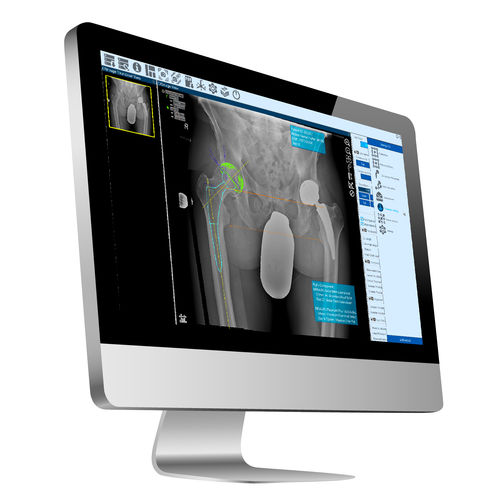 Software visualizzatore - ZedView2.5D - LEXI Co. - di pianificazione / di trattamento / d’importazione