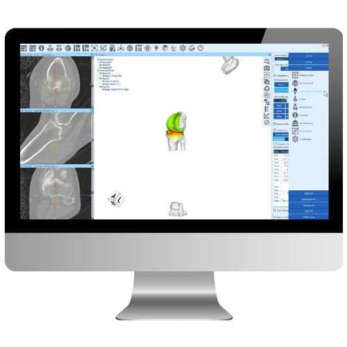 Software di pianificazione - ZedView - LEXI Co. - per ospedale / per tomografia computerizzata / per chirurgia del ginocchio