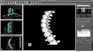 Software visualizzatore - ZedView - LEXI Co. - di pianificazione / d’importazione / medico