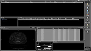 Software visualizzatore - ZedView - LEXI Co. - di pianificazione / di trattamento / d’importazione