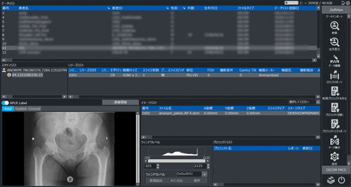 Software visualizzatore - ZedView2.5D  - LEXI Co. - di pianificazione / di trattamento / d’importazione