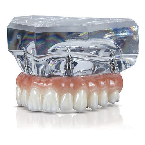 Modello anatomico odontoiatrico - BruxZir® - Glidewell Direct - per implantologia / di dimostrazione
