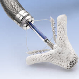 Clip chirurgico per trattamento percutaneo delle insufficienze mitraliche - MitraClip&reg; - MitraClip