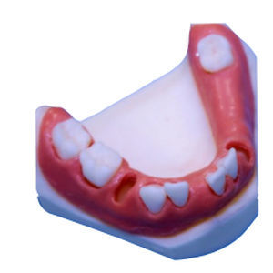 Modello anatomico di mandibola - DM – 116 - Selmodels SL - per chirurgia odontoiatrica