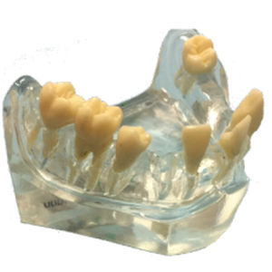 Modello anatomico di mandibola - DM – 2002 - Selmodels SL - per chirurgia odontoiatrica / per implantologia / trasparente