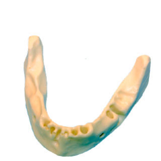 Modello anatomico osseo - DM – 608  - Selmodels SL - di mandibola / per implantologia