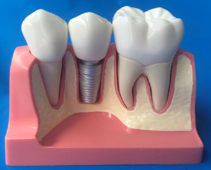 Modello anatomico odontoiatrico - MM-101 - Selmodels SL - per implantologia / flessibile