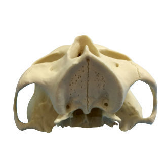 Modello anatomico osseo - ZYGOMA - Selmodels SL - di mascella / per implantologia