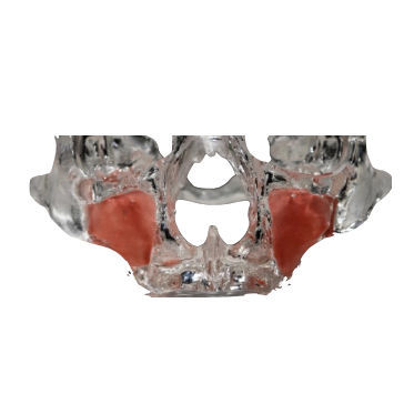 Modello anatomico di mascella - 3D-111-T - Selmodels SL - trasparente