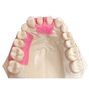 Modello anatomico odontoiatrico - BOPT -1 - Selmodels SL - gengivale